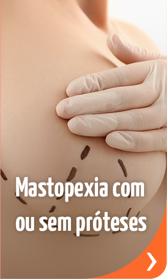 Mastopexia com ou sem próteses - Aurora by Evive