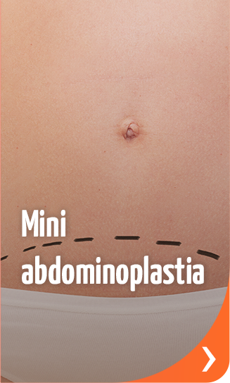 Procedimentos - Mini abdominoplastia