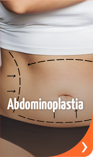 Abdominoplastia - Procedimentos do Mommy Makeover Aurora by Evive